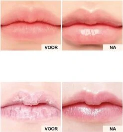 2 Stuks DAG En Nacht Lip Plumpers | Natuurlijke Lip Plumpers | 50% Vollere Lippen In 2 Min | Lip Filler | Lipgloss | Lip Maximizer | Cadeautip | In Een Schattige Cadeauverpakking! -Bekend Cosmetica Winkel 1118x1200 2