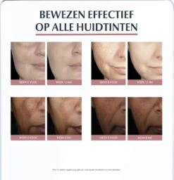 Eucerin Anti-Pigment Spotcorrector - Concealer - 5 Ml -Bekend Cosmetica Winkel 1157x1200 3