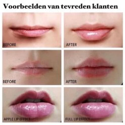 BenjaBeauty Lip Plumper - Lippen - Lipstick - Lippenbalsem - Rood - Wit -Bekend Cosmetica Winkel 1200x1200 322