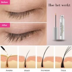 Holland Rose® Luxury Beauty - Wimperserum - Cadeau - Wimper Groeimiddel - Lange En Volle Wimpers - Dikke Wimpers - Wimperserum - Wimper Lifting - 7ml -Bekend Cosmetica Winkel 1200x1200 468