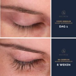 Skines® Wimperserum Premium – Eyelash Serum - Wenkbrauw Serum - Wimper Groei - 3ML -Bekend Cosmetica Winkel 1200x1200 499