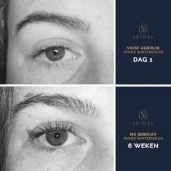 Skines® Wimperserum Premium – Eyelash Serum - Wenkbrauw Serum - Wimper Groei - 3ML -Bekend Cosmetica Winkel 1200x1200 500