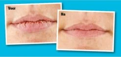 O'Keeffe's Lip Repair Verkoelend 10 O'Keeffe's Lip Repair Verkoelend -Bekend Cosmetica Winkel 1200x568 1