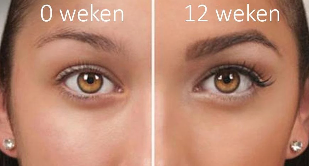 100% Natuurlijke Groei - Wenkbrauwserum - Vollere Wenkbrauwen - Castor Olie - Wenkbrauw Serum - 10ML 7 100% Natuurlijke Groei - Wenkbrauwserum - Vollere Wenkbrauwen - Castor Olie - Wenkbrauw Serum - 10ML - Afbeelding 5