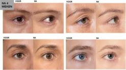 L'Oréal Paris Clinically Proven Wimperserum - 2 Ml -Bekend Cosmetica Winkel 1200x670