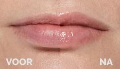 Instant Effects - 3D Lip Plumper Lipgloss Lip Filler - 20% Vollere Lippen In Slechts 2 Minuten! -Bekend Cosmetica Winkel 1200x696